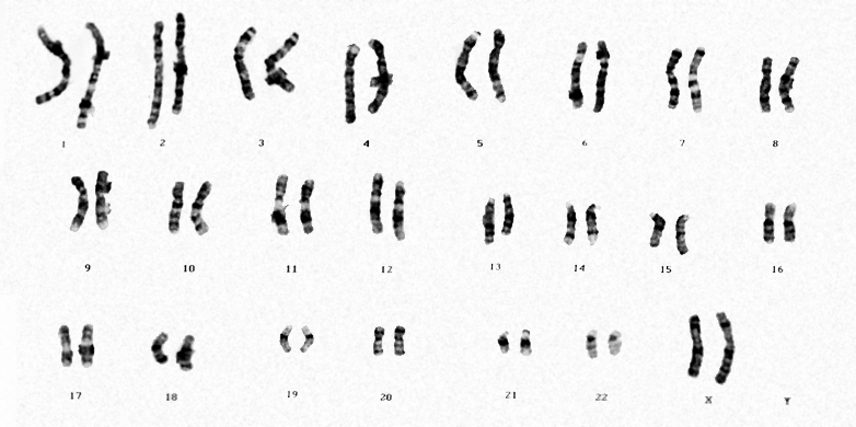 Vergrösserte Ansicht: Chromosomensatz