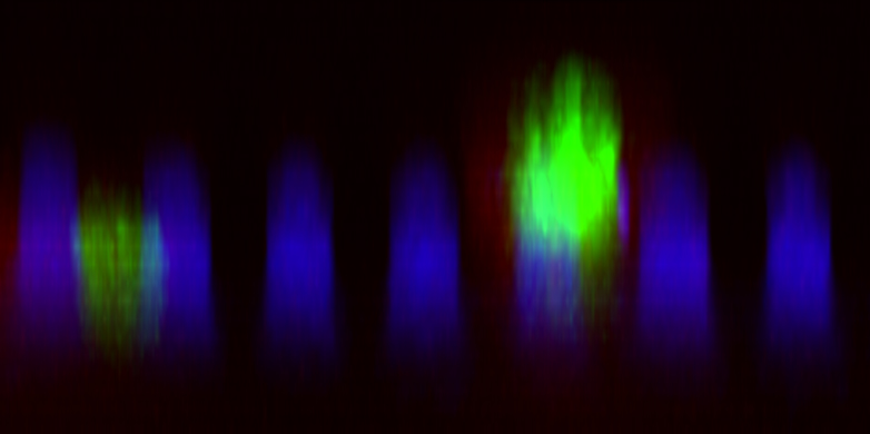 Vergrösserte Ansicht: Seitenansicht des «Mikronagelbretts». In Blau sind die Säulen sichtbar, in Grün Epithelzellen, wobei sich eine davon (rechts) für die Teilung nach oben gehievt hat (mikroskopische Aufnahme). (Bild: Sorce B et al. Nature Communications 2015)