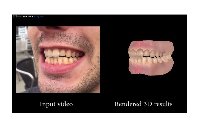 Grafik mit links Foto der Zähne, rechts das digitale Modell