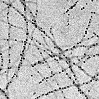 Amyloid-Fibrillen mit Eisen-Nanopartikeln