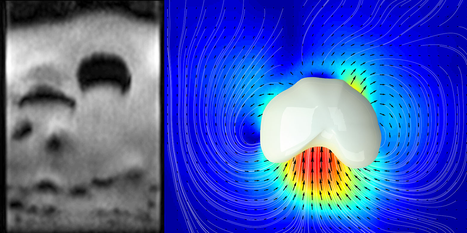 Vergrösserte Ansicht: ETH-Forscher haben aufsteigende Blasen in gasdurchströmten granularen Medien mit Magnetresonanztomographie sichtbar gemacht (links). Auch die Geschwindigkeiten der einzelnen Partikel (Pfeile im rechten Bild) können so gemessen werden. (Bild: Alexander Penn / ETH Zürich)
