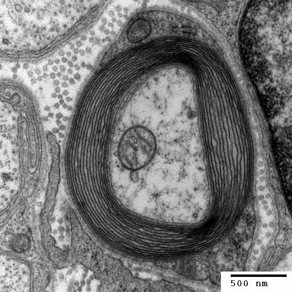 Vergrösserte Ansicht: Wie Jahrringe eines Baums: Schichten von Myelin umhüllen eine Nervenfaser. (Bild: wikimedia commons)