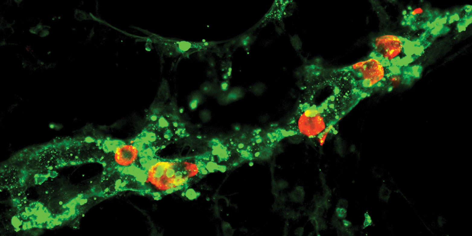 ymphgefässe in der Lunge (grün) verstärken die Ausbreitung von metastatischen Melanomzellen (rot) von Organ zu Organ zusätzlich zur Verbreitung der Krebszellen aus Primärtumoren. (Bild: Science Advances / Michael Detmar Group)