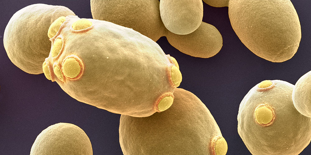 Vergrösserte Ansicht: Hefezellen verschieben bei der Teilung unerwünschtes Genmaterial in die Mutterzelle, damit die unbelasteten Tochterzellen eine neue Population aufbauen können. (Bild: Univ. Basel /SNI/Nano Imaging Lab)