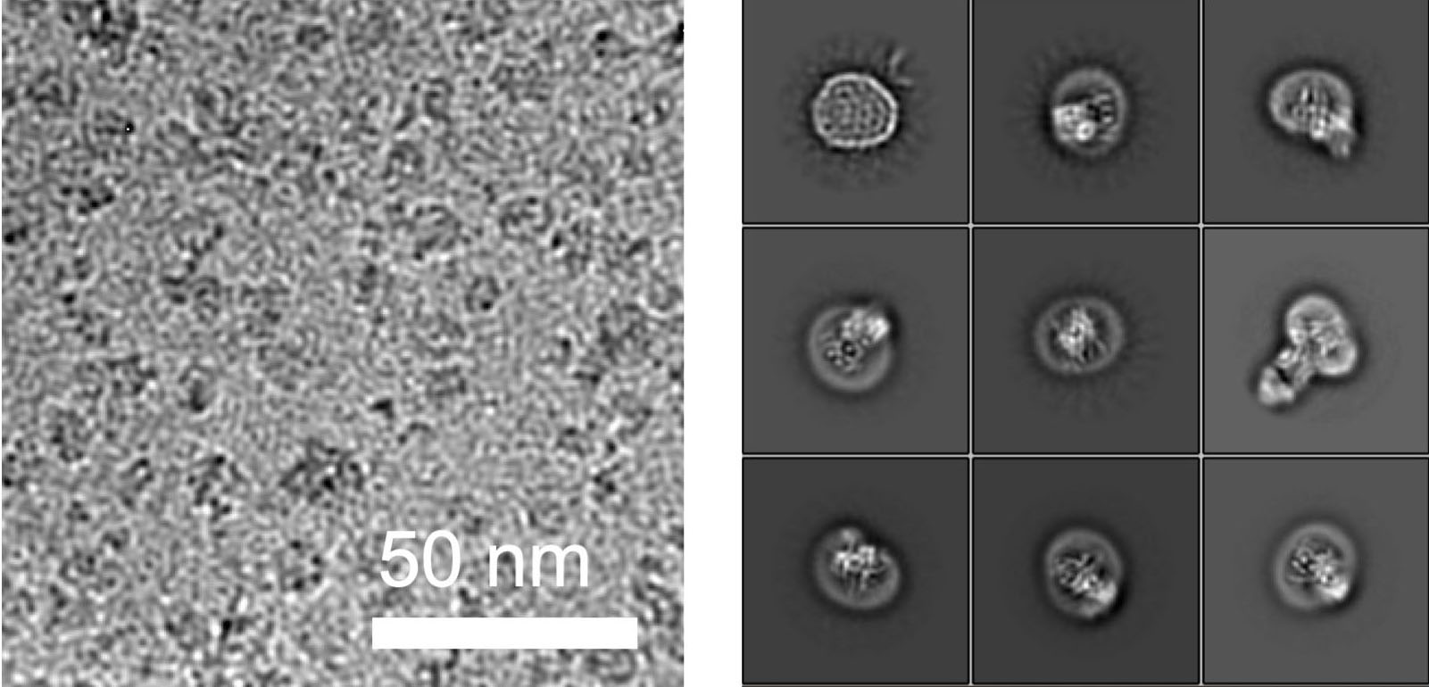 Links: Kryo-EM Bild von ALG6-Antikörper-Partikeln. Rechts: 2D-Klassen von gemittelter ALG6-Fab Partikel. (Grafik: ETH Zürich / Joël Bloch)