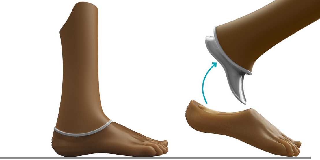 Visualisierung der neu entwickelten Prothese mit abnehmbarem Fuss