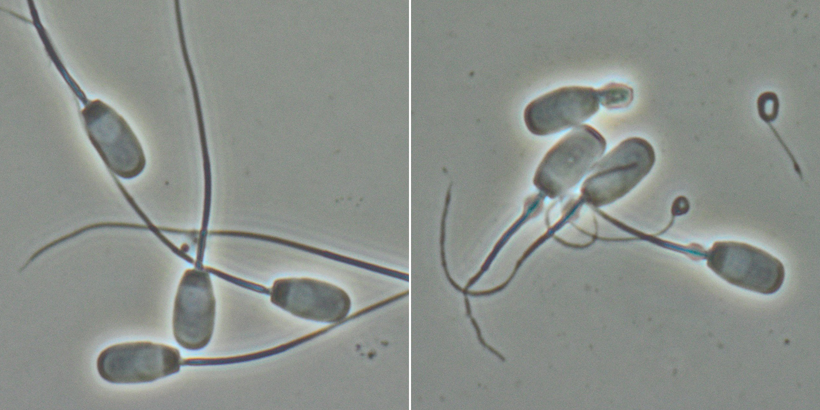 Normale und defekte Spermien unter dem Mikroskop