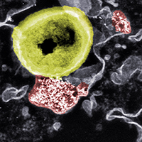 Nanopartikel und resistentes Bakterium