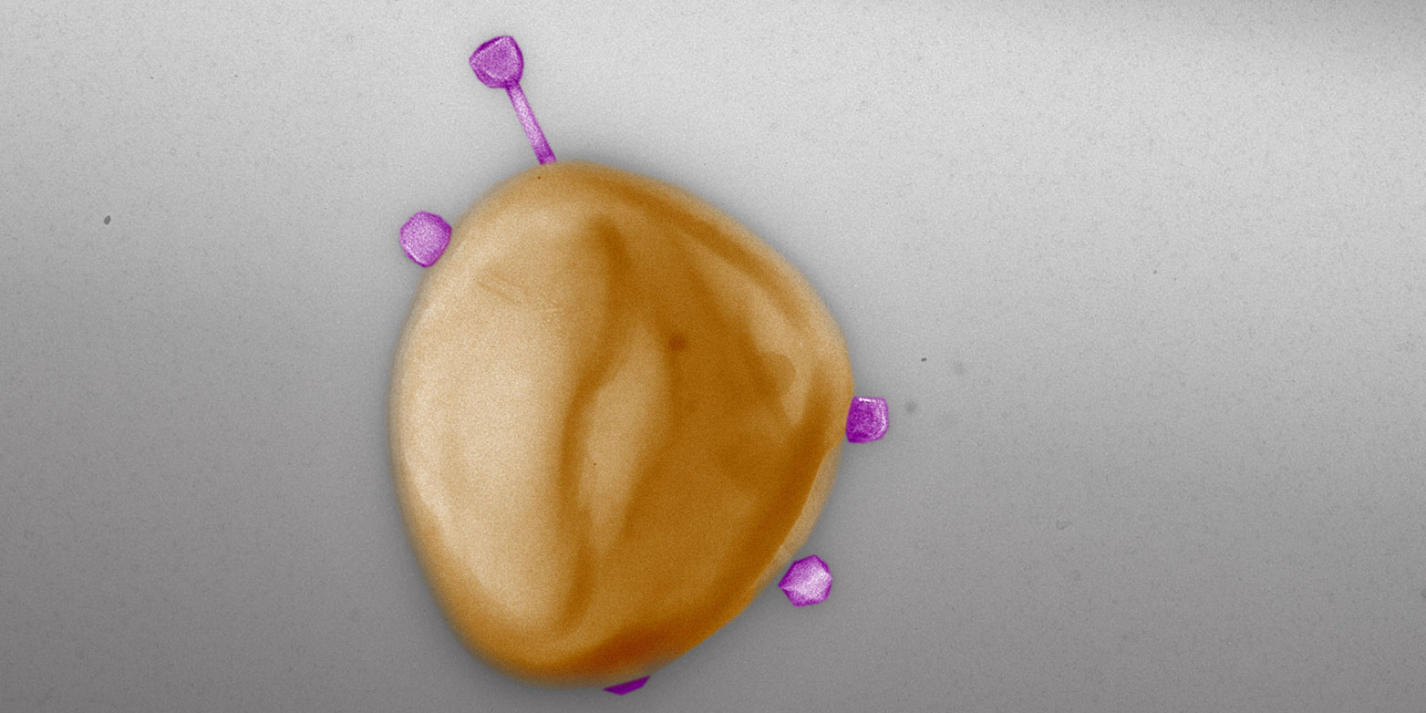 Mehrere Phagen gleichzeitig befallen während einem der Experimente eine Staphylokokken-Zelle. Gut möglich, dass einer davon ein Antibiotikum-Resistenzgen im Genom trägt. (Bild: Pauline Göller/ETH Zürich)