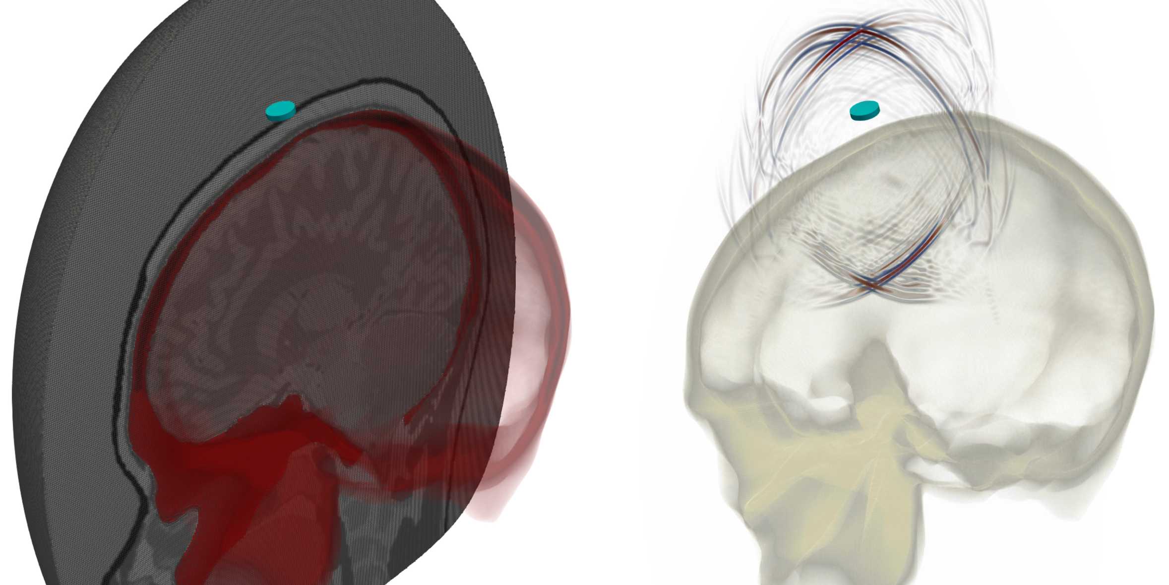 Zwei Bilder. Links zeigt ein hexaedrisches Finite-Elemente-Netz des Schädels und des Gehirns. Rechts: Eine Momentaufnahme der resultierenden Ultraschallsimulation. Die blaue Scheibe in beiden Bildern repräsentiert die Ultraschallquelle.