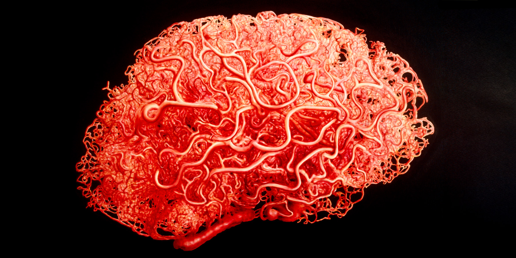 Gehirn simuliert aus Blutgefässen