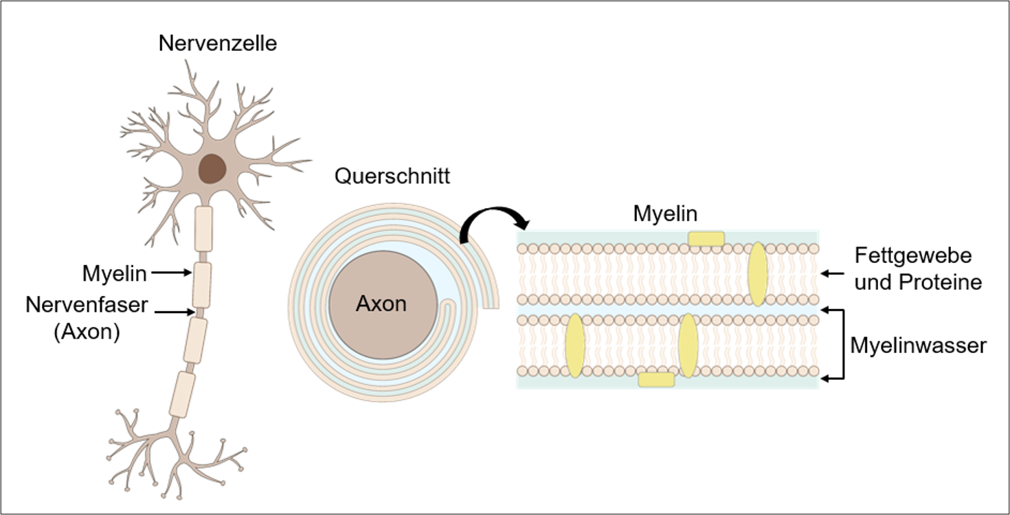 Vergrösserte Ansicht: Querschnitt der Nervenzelle, bestehend aus Axon und Myelin. Das Myelin besteht aus zwei Schichten Fettgewebe und Proteinen mit dazwischen jeweils Myelinwasser.
