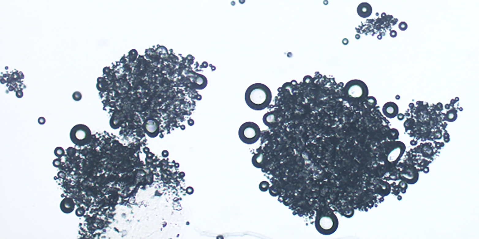 Mikrogeschäumtes microPow-Aromapulver unter dem Mikroskop (Quelle: microPow)