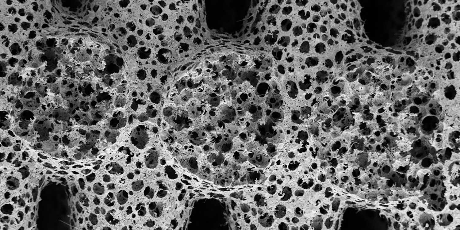 microscopic picture of ultraporous foam