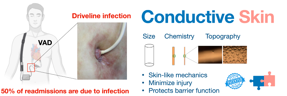 Enlarged view: Conductive skin - A novel device for infection-free power transfer to life-saving therapeutic implants