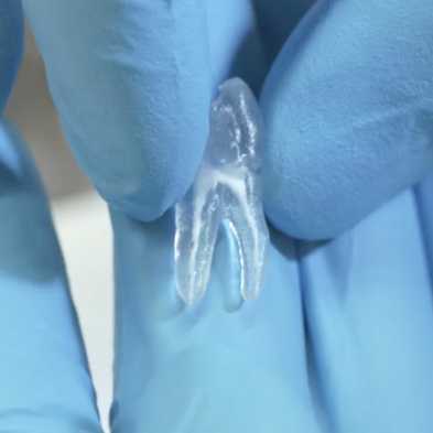 Artificial tooth filled with our material