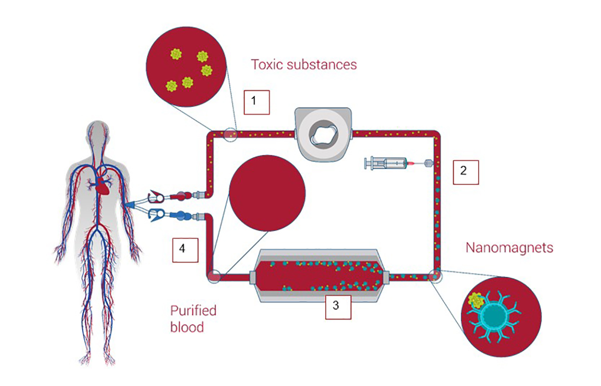 illustration showing how the blood purification outside the body works.