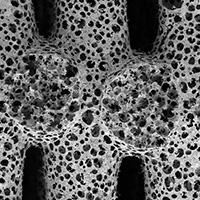 microscopic picture of ultraporous surface