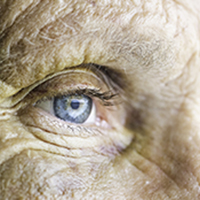 Aging eye