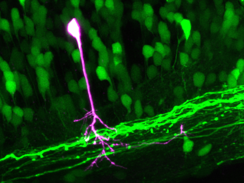 Enlarged view: Motor neurons of a living zebrafish larva in the spinal cord