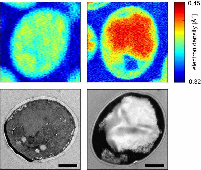 Yeast cells producing starch are visualized by cryo X-ray ptychographic tomography, which reveals the density inside the cells (top), and electron microscopy (bottom). The cells on the left are not modified and free of starch. The scale bar is 1 µm.
