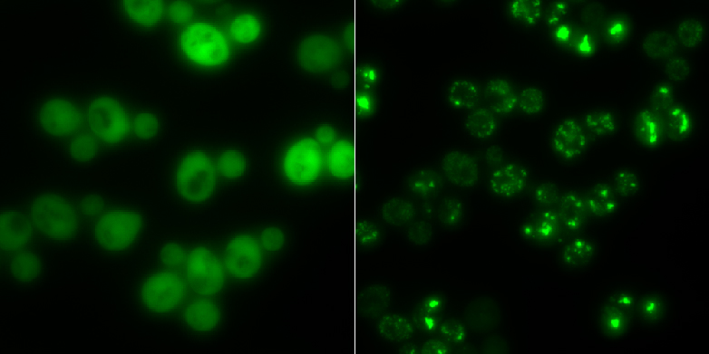 Enlarged view: Yeast cells without protein aggregates (left) and those with (bright luminous spots): In times of starvation, the clumps serve as temporary storage for proteins. (Picture: Group Matthias Peter / ETH Zurich)