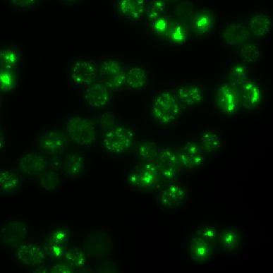 yeast cells with aggregates
