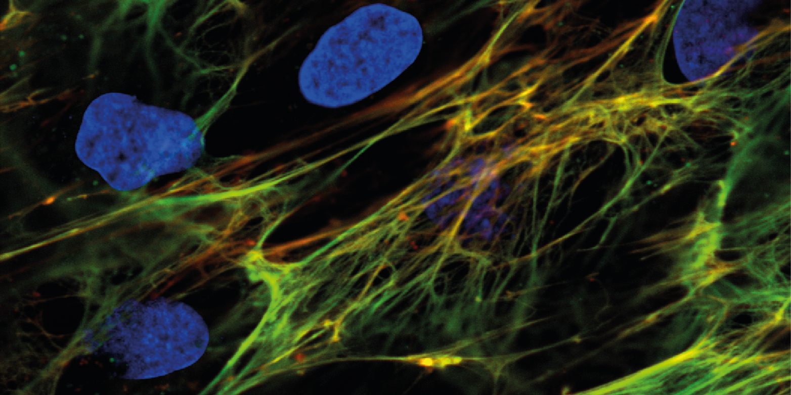 Enlarged view: Cells are surrounded by extracellular matrix fibres, which they stretch and thereby change their functionality. The cell nuclei (blue) are shown together with fibronectin fibres (green), whereby the relaxed fibres are stained with a bacterial peptide (red). (Image: Viola Vogel group / ETH Zurich)