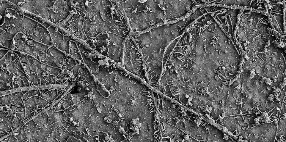 Enlarged view: After a few weeks in soils, numerous soil microorganisms colonized the surface of the PBAT films and had begun to biodegrade the polymer. (Electron microscopy images: ETH Zurich / Environmental Chemistry Group)
