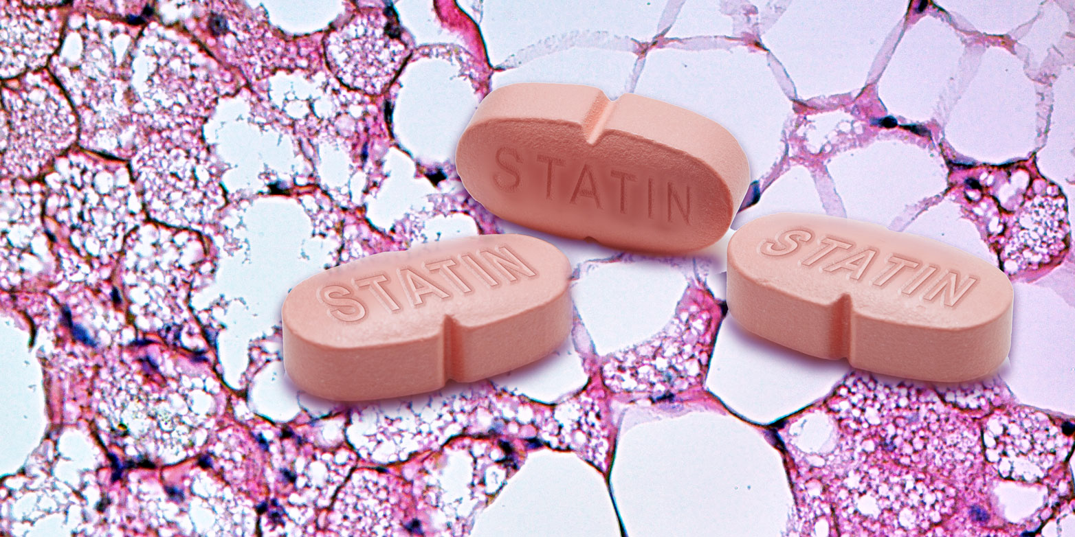 Statins reduce brown adipose tissue. (Photograph: ETH Zurich, montage)