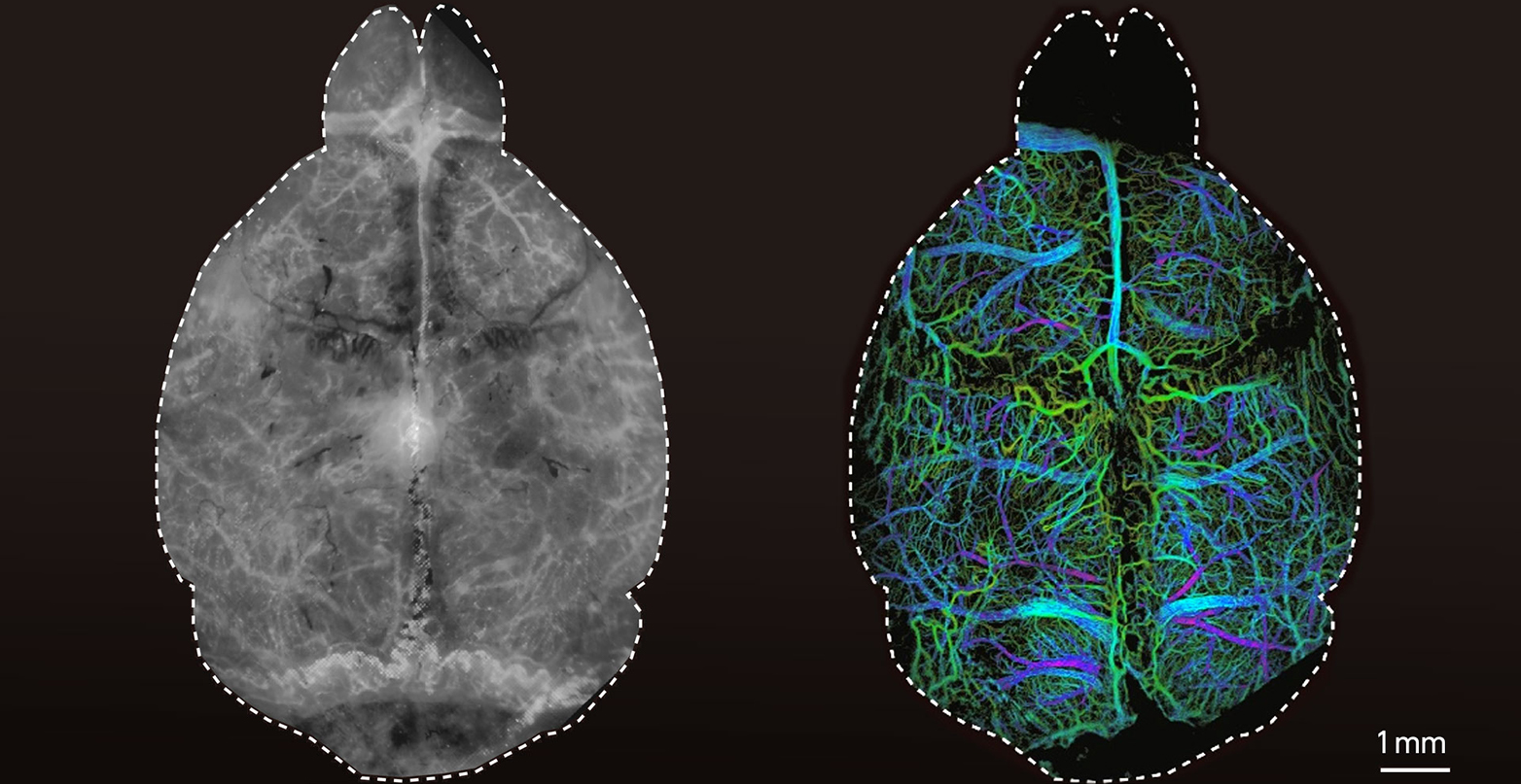 Two mouse brains, a conventional image on the left and a fluorescence image on the right.