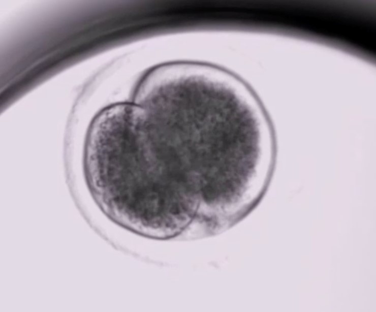 Embryo of a deer under the microscope