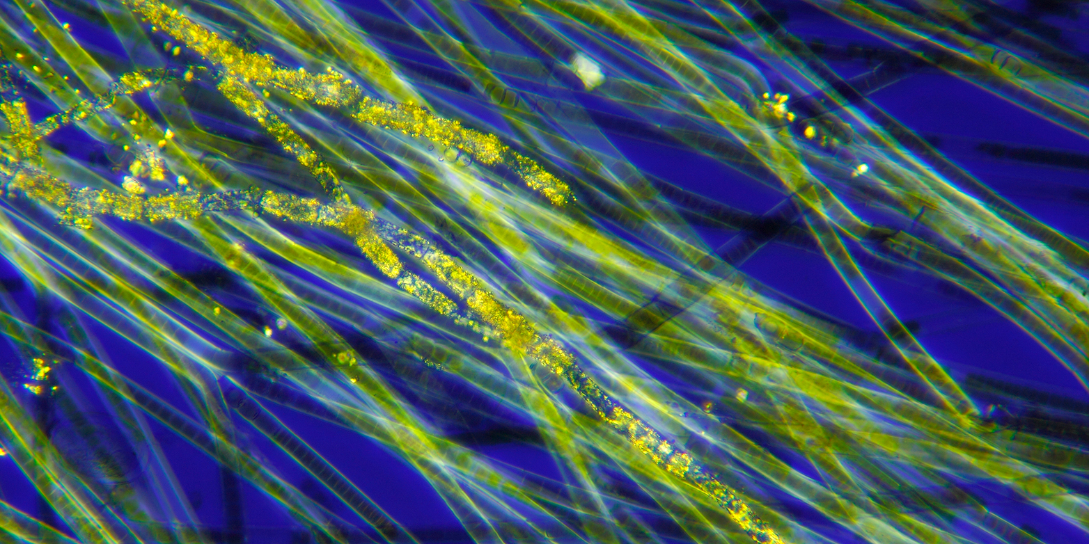 Cyanobacteria under a microscope