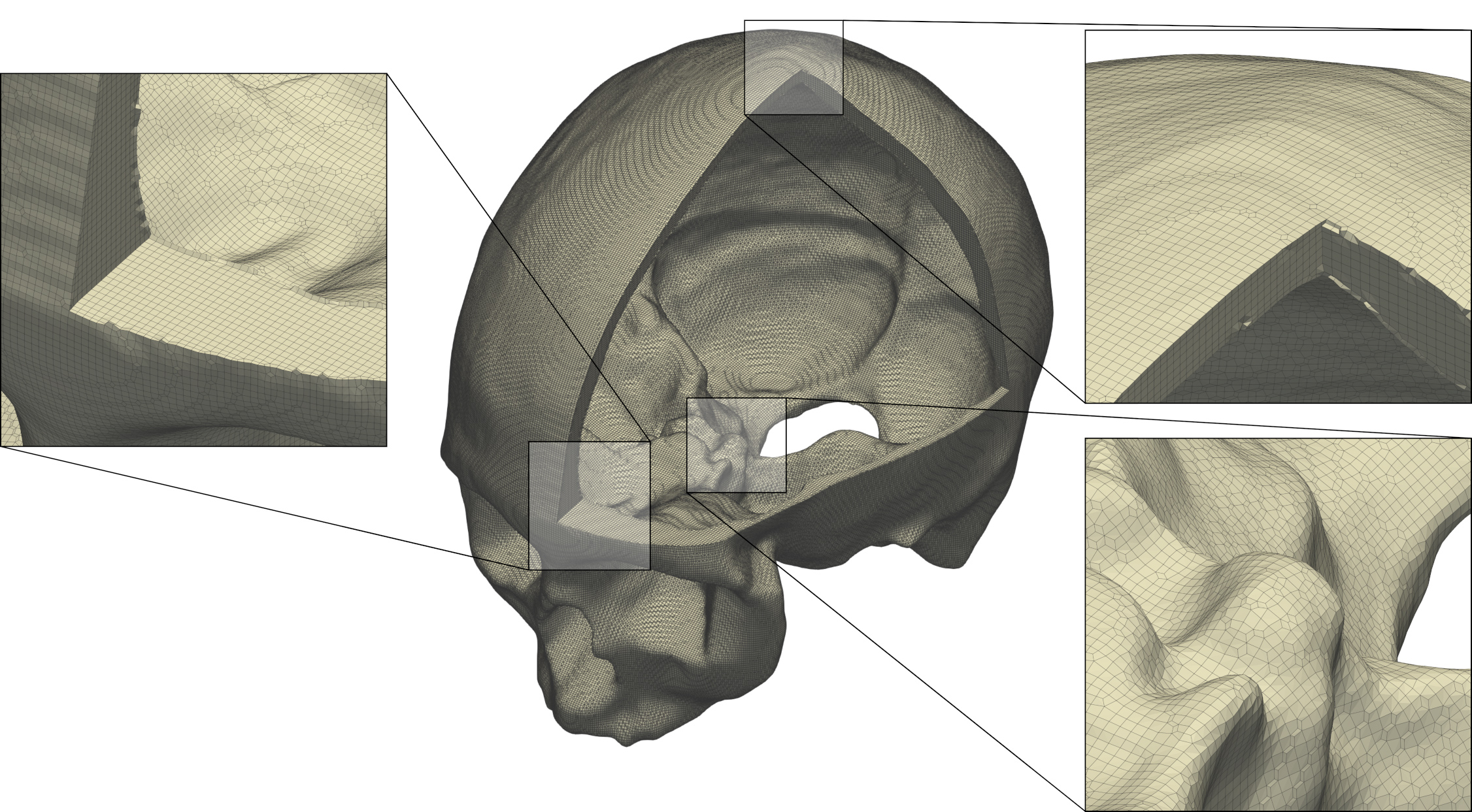 A hexahedral finite-element mesh of the skull with different detailed views.