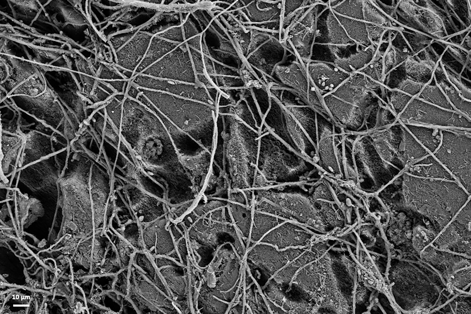 Elektronenmikroskopiebild von Plastik und Pilzfäden, die sich darauf angesiedelt haben