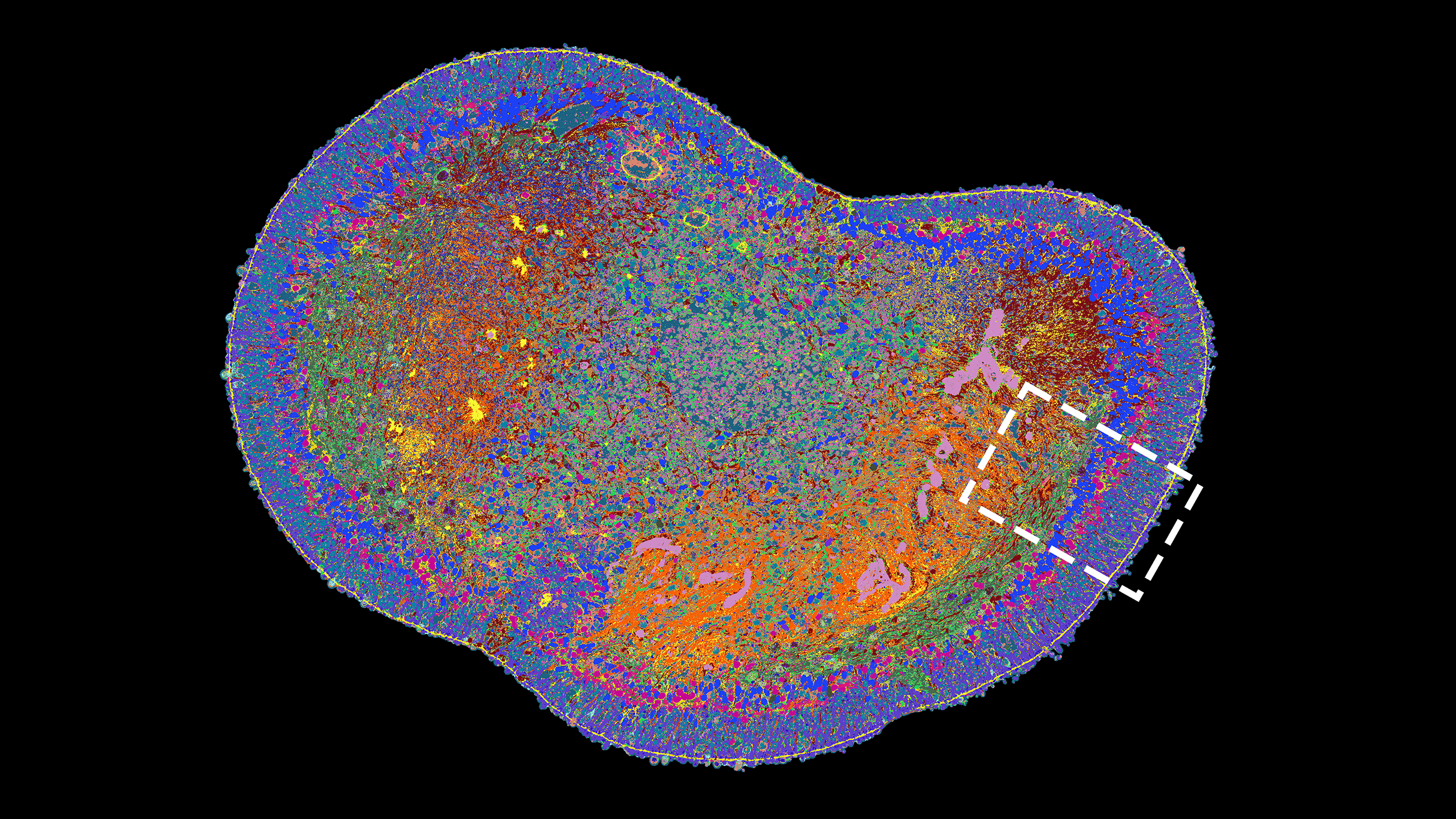 Enlarged view: Cross-section of a whole retinal organoid. Different proteins are made visible with different colors.