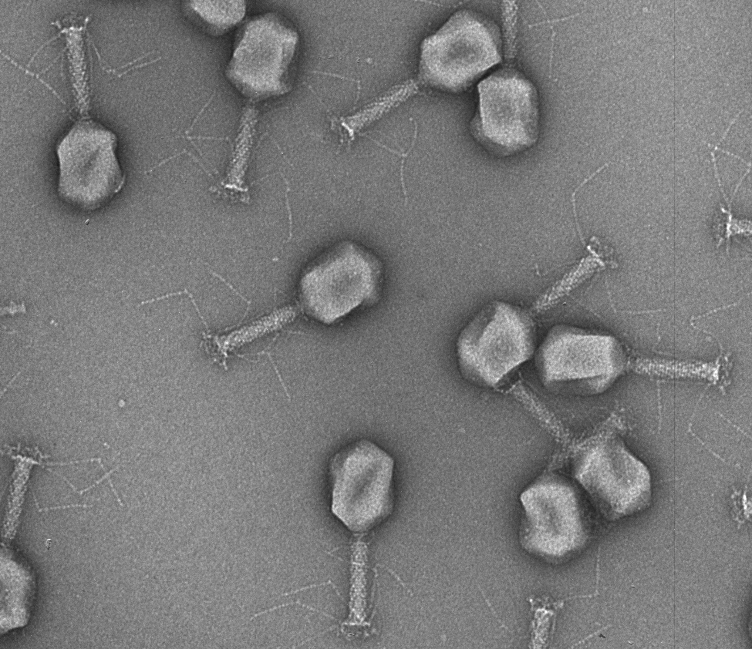 Electron micrograph of phages