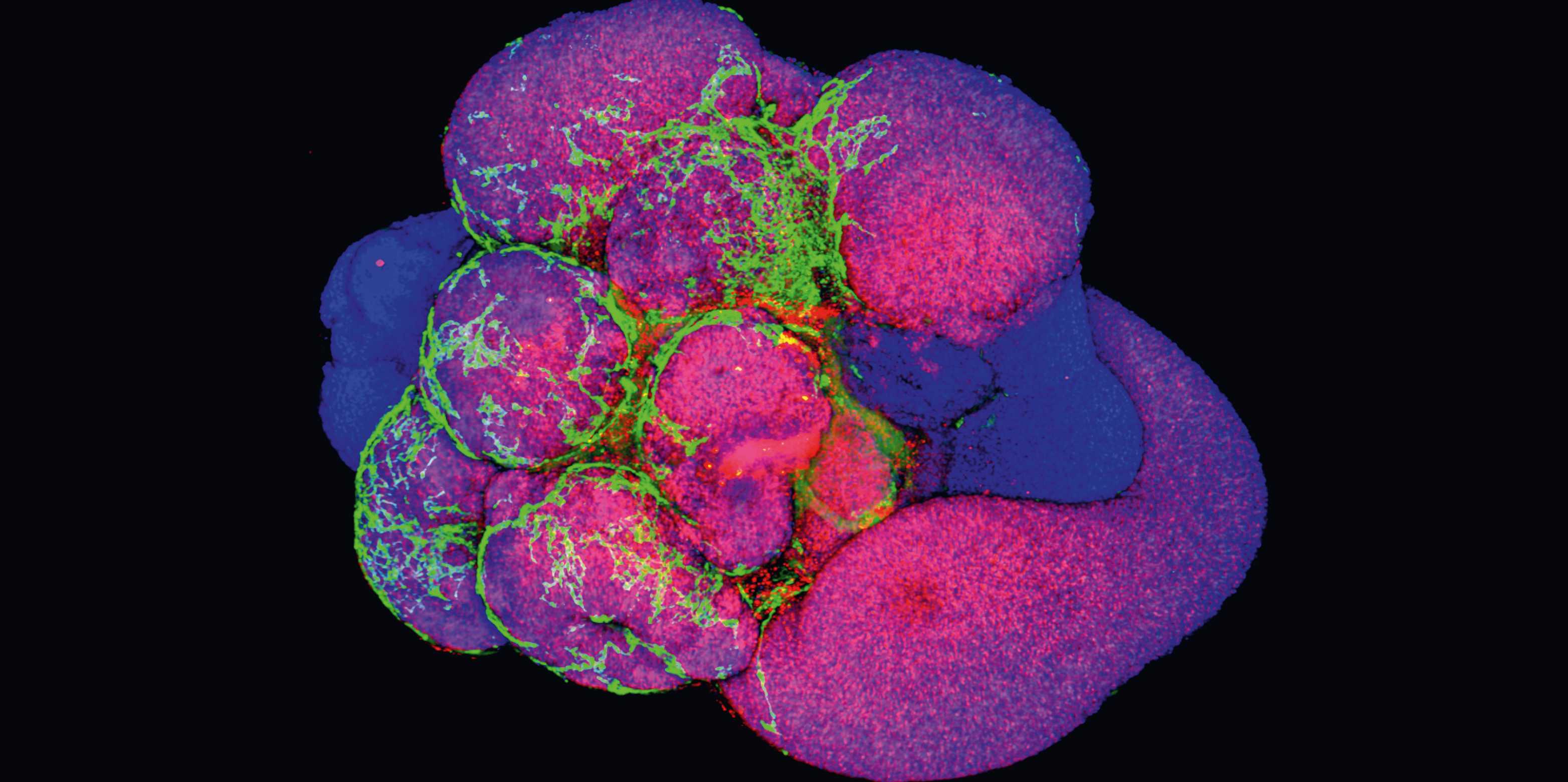 Brain organoid with visualized vascular structures