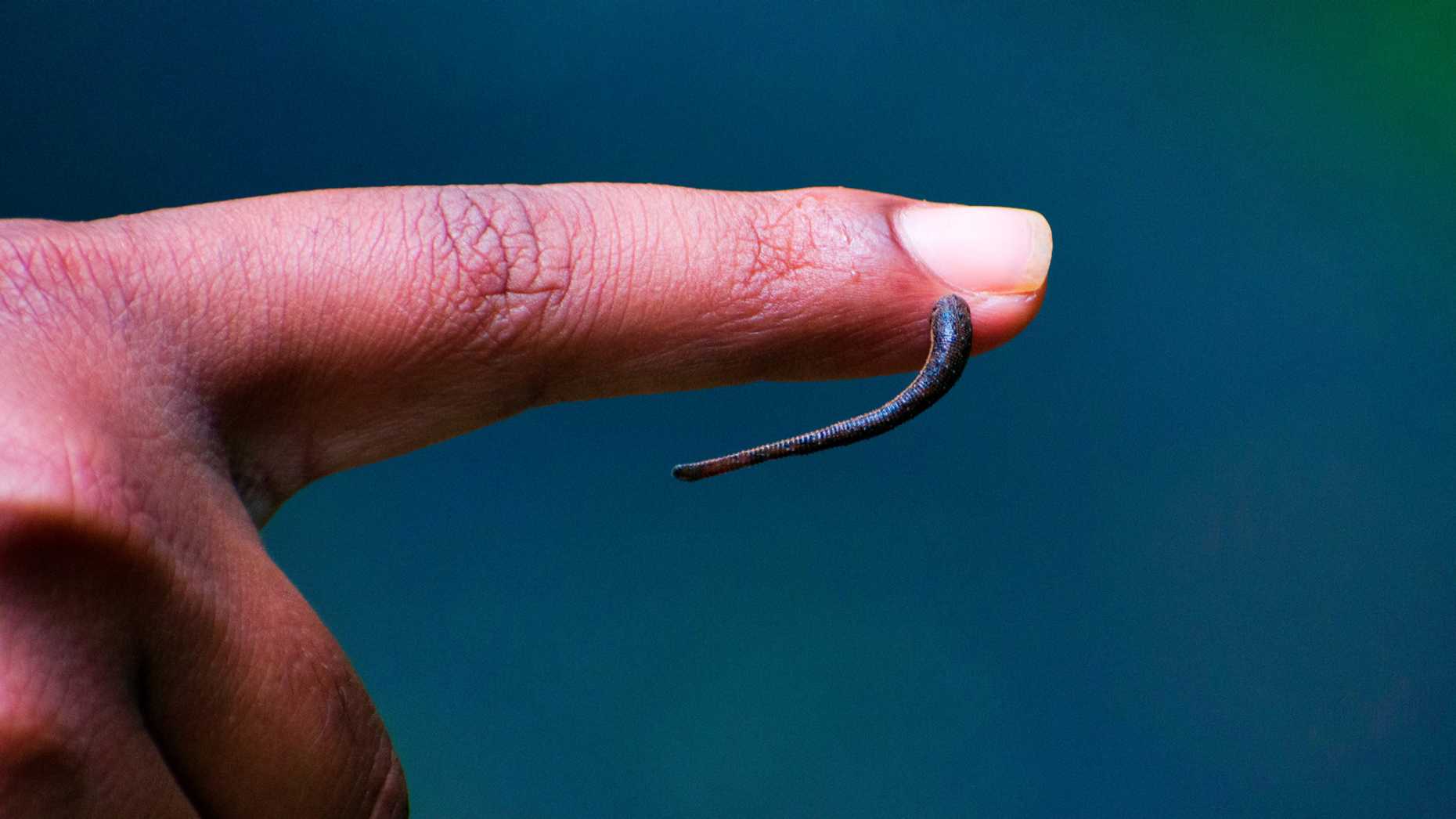 Finger with a leech hanging from it