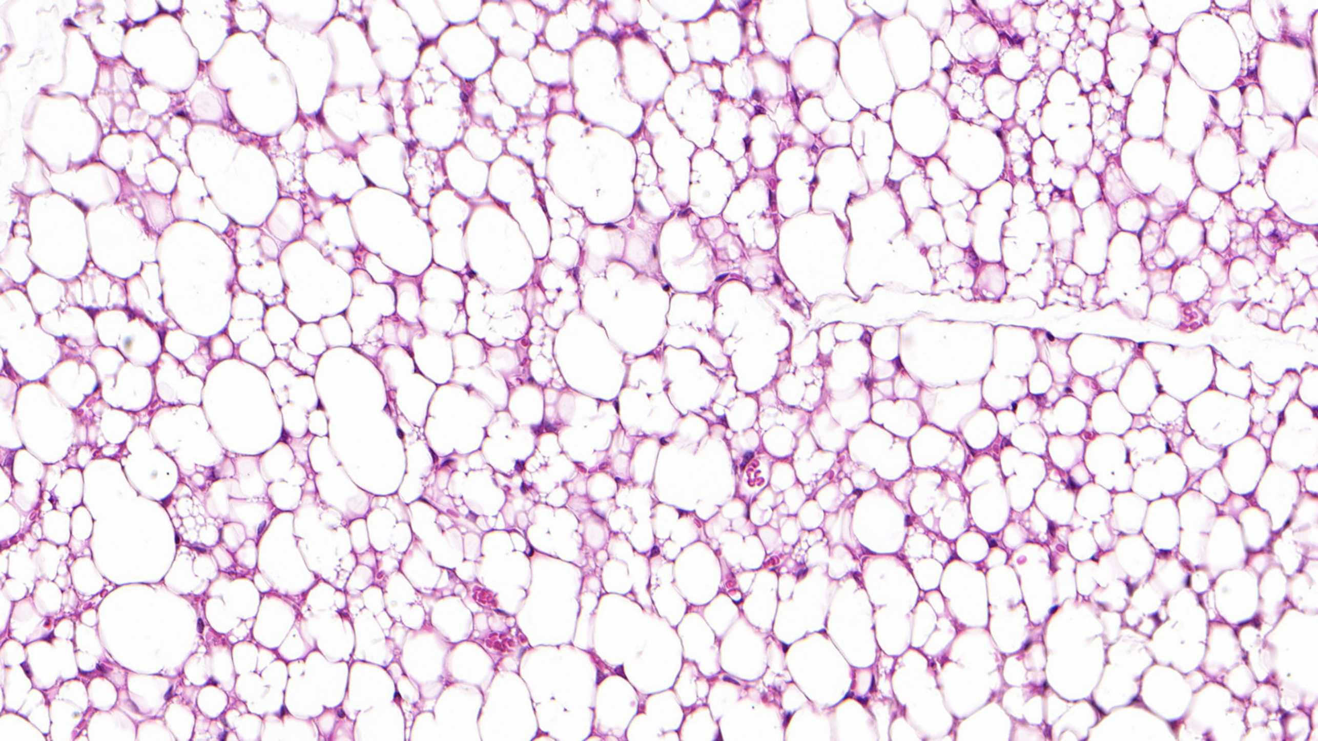 Enlarged view: Microscopy image of the fatty tissue