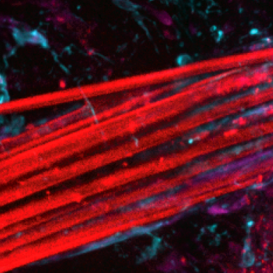 A bundle of thin electrode fibres in the brain