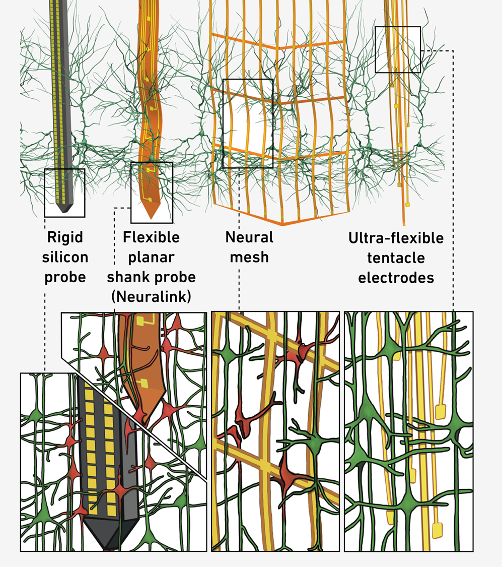 Enlarged view: The tentacle electrodes and coarser electrodes and an electrode grid.