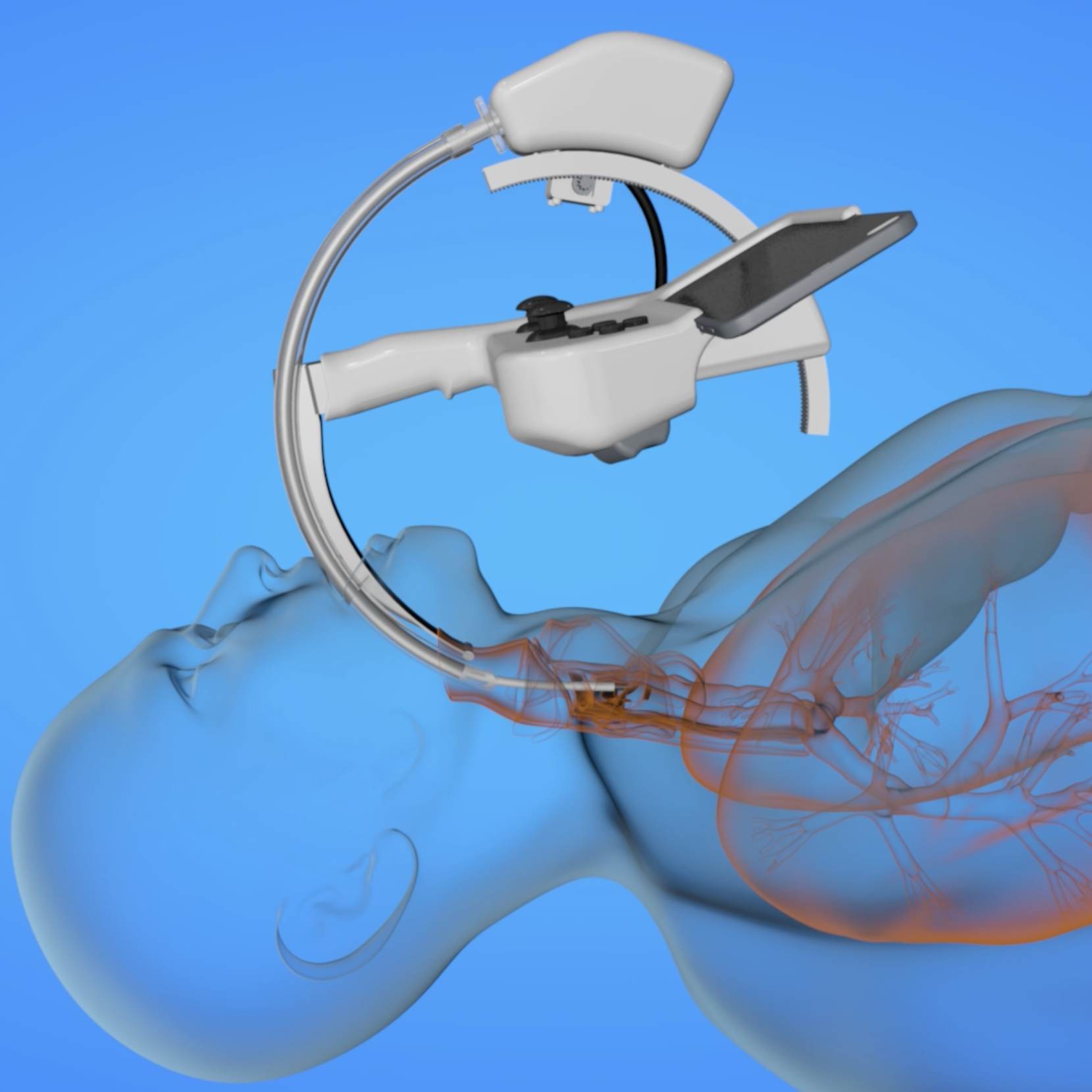 Enlarged view: Simulation of the endoscope with AI